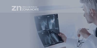 Clínica de Fraturas Zona Norte em Santana