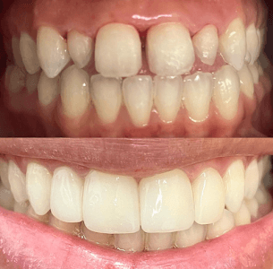 DRA.EMILIA CRISTINA/ PROFESSORA ESPECIALISTA EM HARMONIZAÇÃO FACIAL E ODONTOLOGIA SÃO PAULO em São Paulo