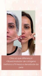 Essenza Estética Avançada - Santana em Santana