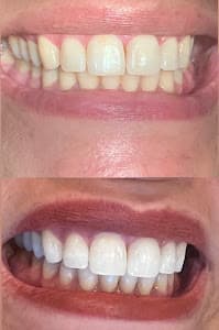 Dra Giulia Augustineli - Dentista em Santana/zona norte sp em Santana