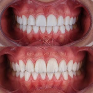 Centro Especializado de Odontologia - Prime Class Odonto em Ipiranga