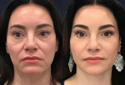 Harmonia Facial São Paulo em Bela Vista